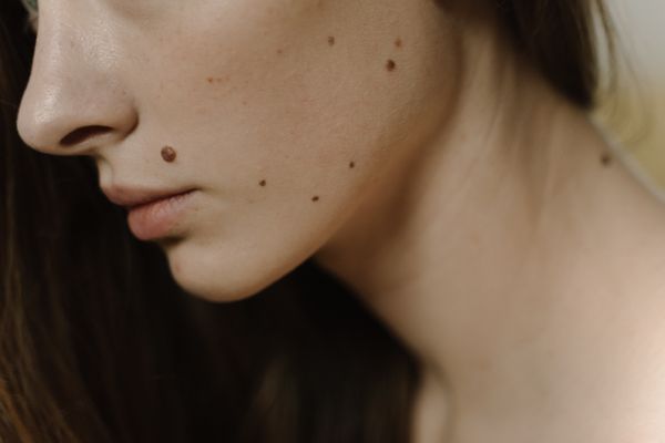 Clear, even skin on the cheek